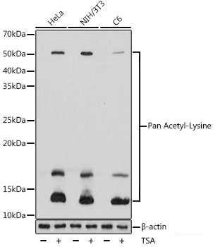 Western blot analysis of extracts of Mouse liver using KRT4 Polyclonal Antibody.