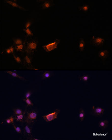 Immunohistochemistry of paraffin-embedded Human stomach using DBH Polyclonal Antibody at dilution of 1:100 (40x lens).