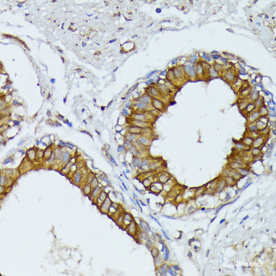 Immunohistochemistry of paraffin-embedded Rat heart using TRAP1 Polyclonal Antibody at dilution of 1:100 (40x lens).