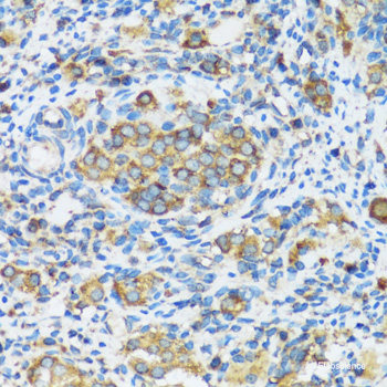 Immunohistochemistry of paraffin-embedded Rat heart using PTPN11 Polyclonal Antibody at dilution of 1:100 (40x lens).