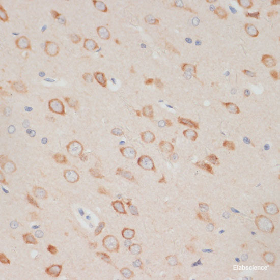 Immunohistochemistry of paraffin-embedded Human lung using APC Polyclonal Antibody at dilution of 1:200 (40x lens).
