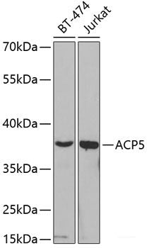 Western blot analysis of extracts of NIH/3T3 cells using CHRM4 Polyclonal Antibody.