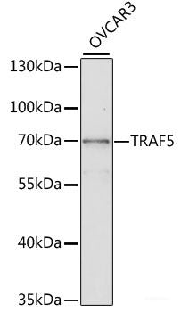 Western blot analysis of extracts of Mouse liver using DRD4 Polyclonal Antibody at dilution of 1:500.