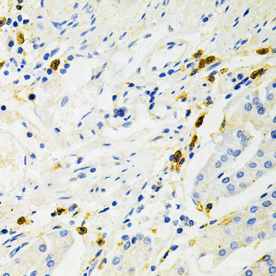 Immunofluorescence analysis of Rat brain using SLC1A1 Polyclonal Antibody at dilution of 1:100. Blue: DAPI for nuclear staining.
