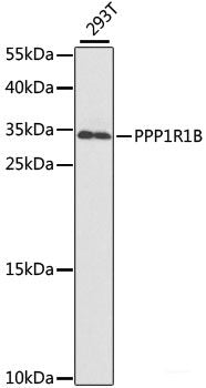 Western blot analysis of extracts of K-562 cells using LHB Polyclonal Antibody at dilution of 1:400.
