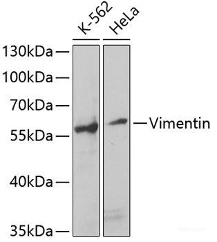 Western blot analysis of extracts of various cell lines using CSF1R Polyclonal Antibody at dilution of 1:500.