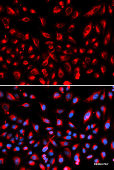 Western blot analysis of extracts of various cell lines using MYL9 Polyclonal Antibody at dilution of 1:1000.