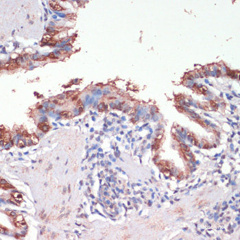 Immunofluorescence analysis of A549 cells using PAX2 Polyclonal Antibody