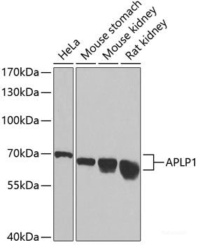 Immunofluorescence analysis of HeLa cells using TRAF3 Polyclonal Antibody