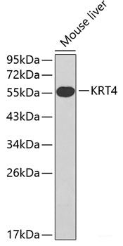 Western blot analysis of extracts of various cell lines using MYSM1 Polyclonal Antibody at dilution of 1:3000.