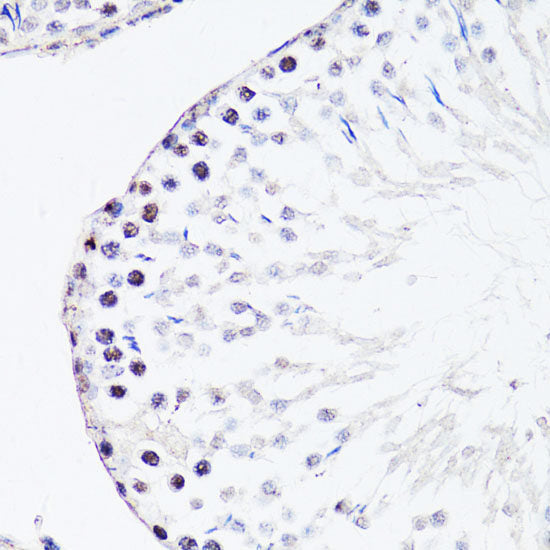 Immunohistochemistry of paraffin-embedded Rat brain using NFkB p100 / p52 Polyclonal Antibody at dilution of 1:100 (40x lens).