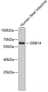 Western blot analysis of extracts of various cell lines using MonoMethyl-Histone H3-R17 Polyclonal Antibody.