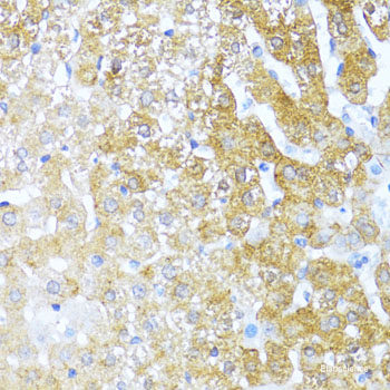 Immunohistochemistry of paraffin-embedded Human esophagus using NTF3 Polyclonal Antibody at dilution of 1:100 (40x lens).