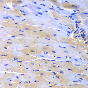 Immunohistochemistry of paraffin-embedded Human stomach using CAMK2G Polyclonal Antibody at dilution of 1:100 (40x lens).