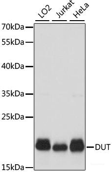 Immunohistochemistry of paraffin-embedded Rat spleen using PAK1 Polyclonal Antibody at dilution of 1:100 (40x lens).