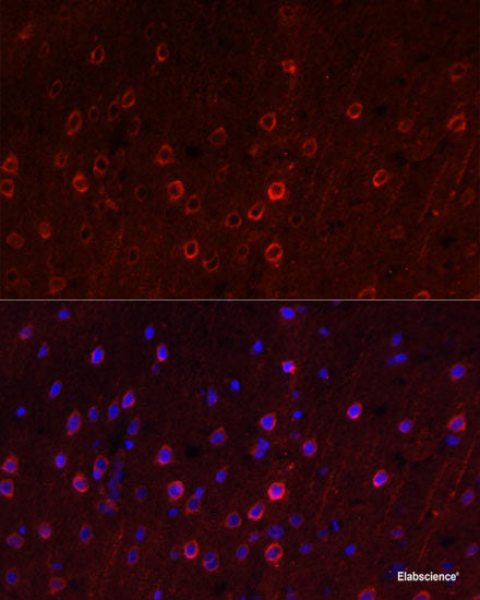 Western blot analysis of extracts of various cell lines using CNGA3 Polyclonal Antibody at dilution of 1:1000.