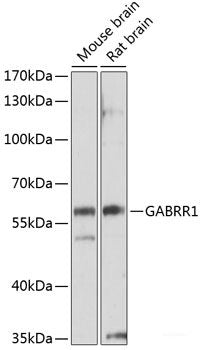 Immunohistochemistry of paraffin-embedded Rat testis using KIFC1 Polyclonal Antibody at dilution of 1:100 (40x lens).