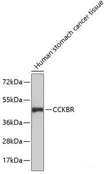 Immunofluorescence analysis of C6 cells using MAP1B Polyclonal Antibody at dilution of 1:100. Blue: DAPI for nuclear staining.