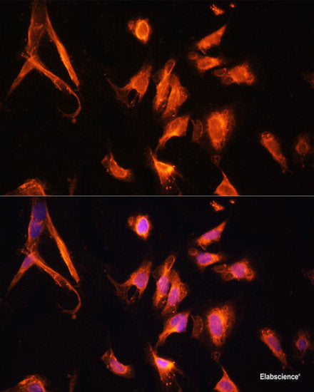 Western blot analysis of extracts of Human brain using CDK14 Polyclonal Antibody.