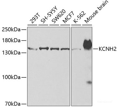 Western blot analysis of extracts of various cell lines using RGN Polyclonal Antibody at dilution of 1:1000.