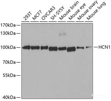 Western blot analysis of extracts of various cell lines using AIM2 Polyclonal Antibody at dilution of 1:1000.
