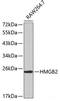 Immunohistochemistry of paraffin-embedded Human lung cancer using LRPPRC Polyclonal Antibody at dilution of 1:100 (40x lens).
