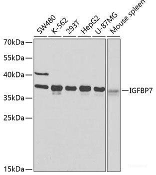 Western blot analysis of extracts of various cell lines using SAMM50 Polyclonal Antibody at dilution of 1:1000.