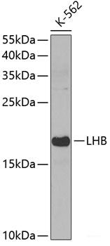 Immunofluorescence analysis of C6 cells using NSUN2 Polyclonal Antibody at dilution of 1:100. Blue: DAPI for nuclear staining.