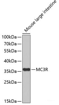 Immunohistochemistry of paraffin-embedded Human colon carcinoma using SLC39A4 Polyclonal Antibody at dilution of 1:100 (40x lens).