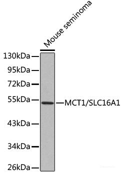 Western blot analysis of extracts of various cell lines using SUGCT Polyclonal Antibody at dilution of 1:1000.