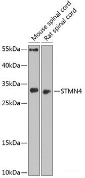 Western blot analysis of extracts of various cell lines using ARHGAP5 Polyclonal Antibody at dilution of 1:1000.