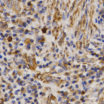 Immunohistochemistry of paraffin-embedded Human stomach using CCT6A Polyclonal Antibody at dilution of 1:100 (40x lens).