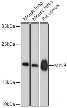 Western blot analysis of extracts of Jurkat cells using DOCK2 Polyclonal Antibody.