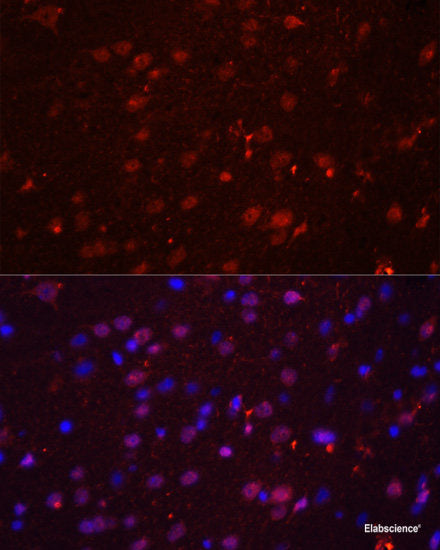 Western blot analysis of extracts of various cell lines using ELOVL4 Polyclonal Antibody at dilution of 1:3000.