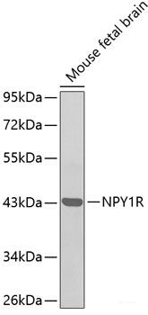 Western blot analysis of extracts of various cell lines using ATP6V1E1 Polyclonal Antibody at dilution of 1:1000.