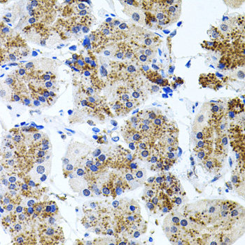 Immunohistochemistry of paraffin-embedded Mouse brain using CD97 Polyclonal Antibody at dilution of 1:100 (40x lens).