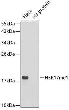 Immunohistochemistry of paraffin-embedded Human liver damage using CETN1 Polyclonal Antibody at dilution of 1:100 (40x lens).