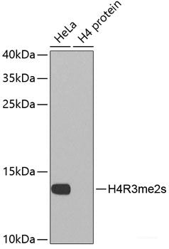 Immunohistochemistry of paraffin-embedded Rat brain using CRYM Polyclonal Antibody at dilution of 1:100 (40x lens).
