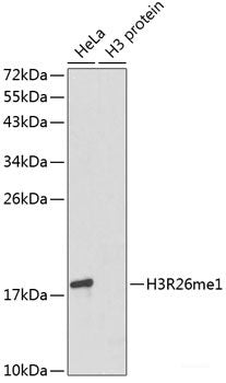 Immunohistochemistry of paraffin-embedded Human colon carcinoma using DACH1 Polyclonal Antibody at dilution of 1:100 (40x lens).