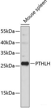 Immunohistochemistry of paraffin-embedded Human liver cancer using FDXR Polyclonal Antibody at dilution of 1:100 (40x lens).