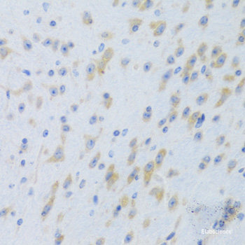 Immunohistochemistry of paraffin-embedded Human colon using FKBP5 Polyclonal Antibody at dilution of 1:100 (40x lens).