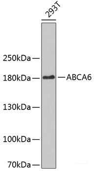Immunohistochemistry of paraffin-embedded Human liver damage using GFPT1 Polyclonal Antibody at dilution of 1:100 (40x lens).