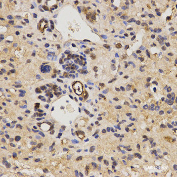 Immunohistochemistry of paraffin-embedded Human stomach using GLS Polyclonal Antibody at dilution of 1:100 (40x lens).