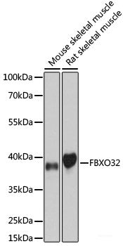 Western blot analysis of extracts of various cell lines using GRK5 Polyclonal Antibody at dilution of 1:1000.