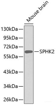 Western blot analysis of extracts of Mouse brain using SPHK2 Polyclonal Antibody.