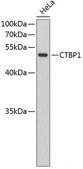 Immunofluorescence analysis of HeLa cells using MOV10 Polyclonal Antibody at dilution of 1:100. Blue: DAPI for nuclear staining.