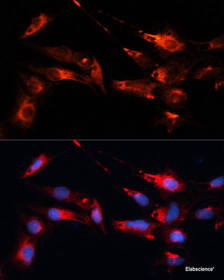Immunofluorescence analysis of HeLa cells using PSMB6 Polyclonal Antibody at dilution of 1:100 (40x lens). Blue: DAPI for nuclear staining.