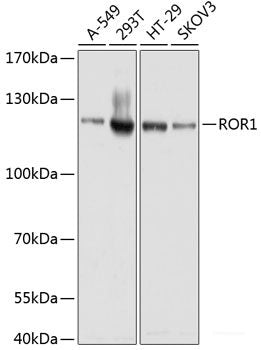 Western blot analysis of extracts of Mouse lung using RGS16 Polyclonal Antibody at dilution of 1:1000.