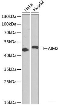 Western blot analysis of extracts of A-431 cells using SRP9 Polyclonal Antibody at dilution of 1:1000.