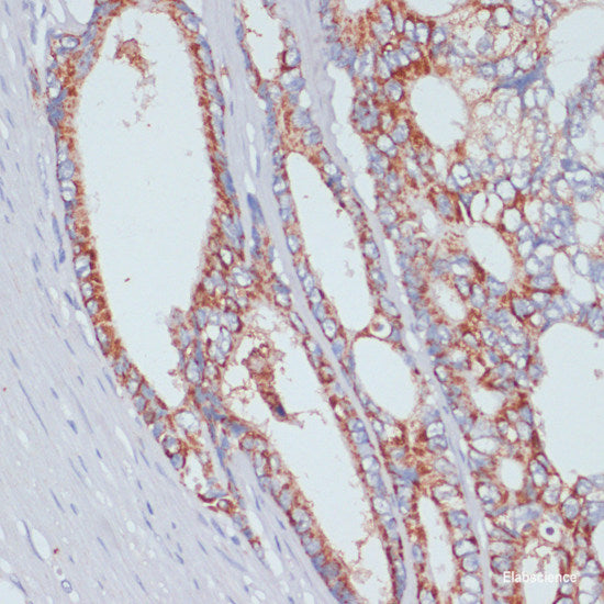Immunohistochemistry of paraffin-embedded Mouse liver using ARHGEF5 Polyclonal Antibody at dilution of 1:100 (40x lens).